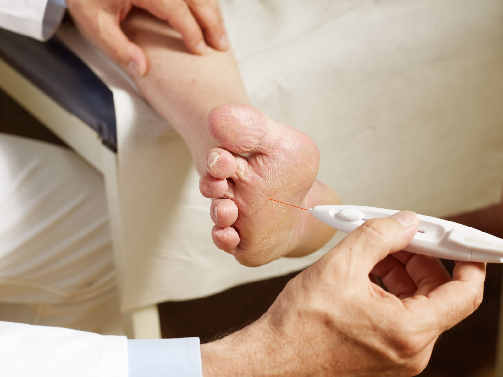 Diabetologie am Nordbahnhof • Diabetesches Fußsyndrom